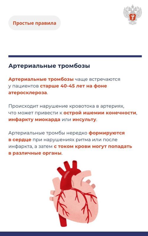 #ПростыеПравила: Откуда берутся тромбы и как снизить риски? #ПростыеПравила: Откуда берутся тромбы и как снизить риски?
