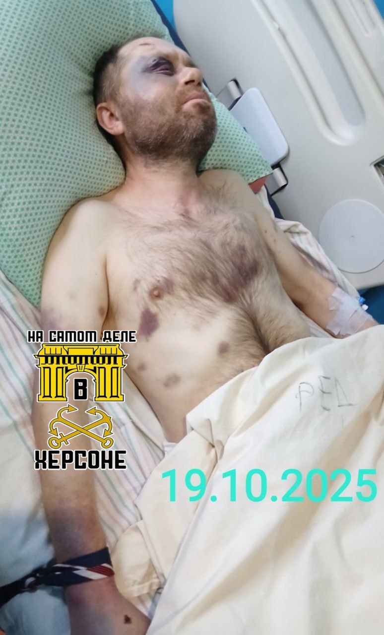 В городе Тараща Киевской области мужчина был жестоко избит и потерял память после контакта с ТЦК