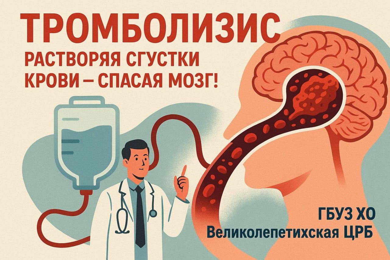 Тромболизис: растворяя сгустки крови – спасая мозг