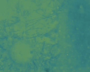 Минус 3 украинских штурмовика!