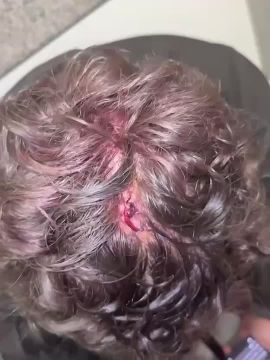 Во Львове соседи избили ветерана "Азова" и его жену, заявив, что он "мешает им стучанием костыля"