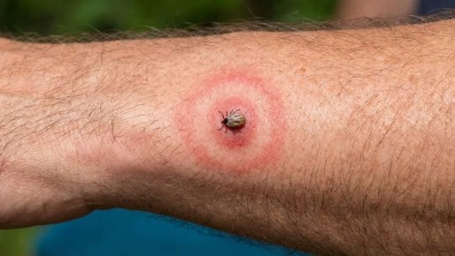 � ��������� ���������� ������� ���������� � ����� ������������ �� ������ ������