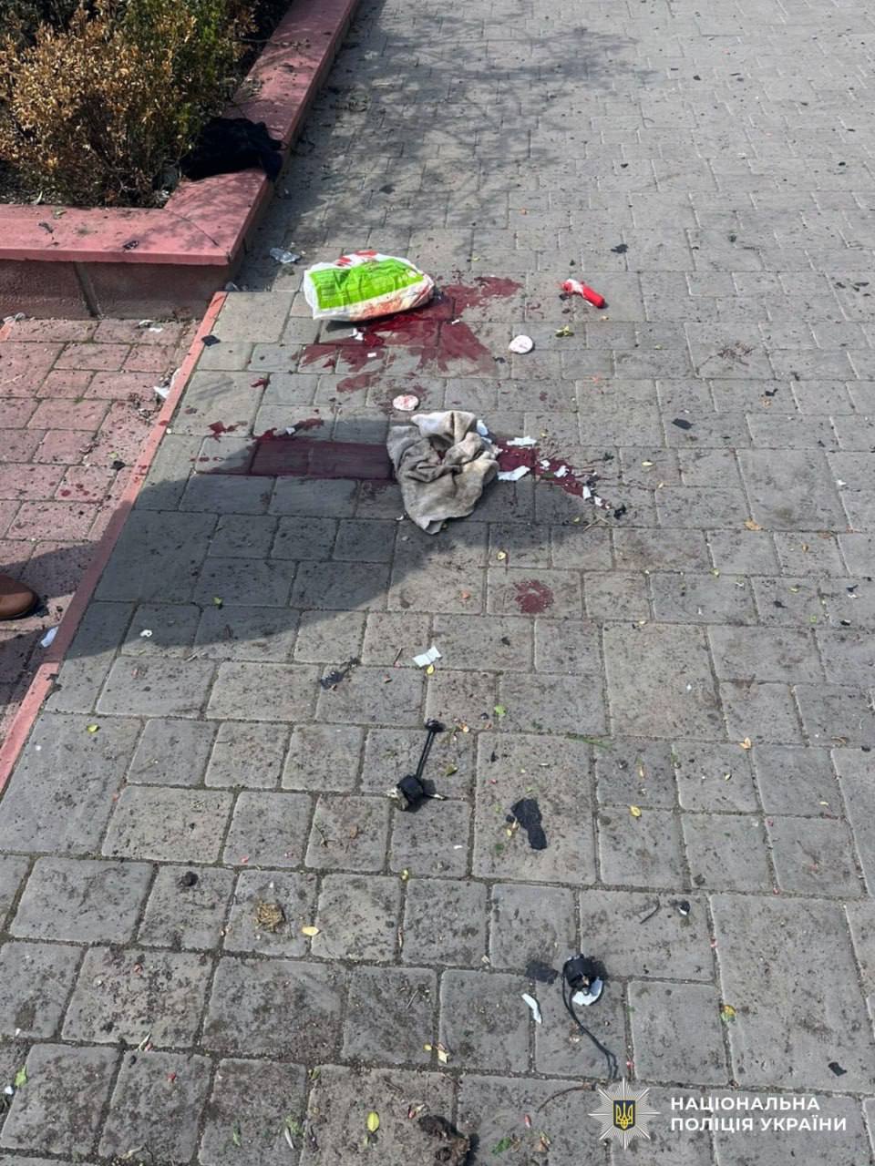 А на том берегу.... Правобережье Херсонщины: вечерний обзор новостей По обстрелам и пострадавшим А на том берегу.... Правобережье Херсонщины: вечерний обзор новостей По обстрелам и пострадавшим