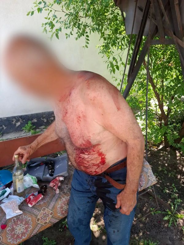 Владимир Сальдо: В результате атак ВСУ за прошедшие сутки ранения получили два мирных жителя Владимир Сальдо: В результате атак ВСУ за прошедшие сутки ранения получили два мирных жителя