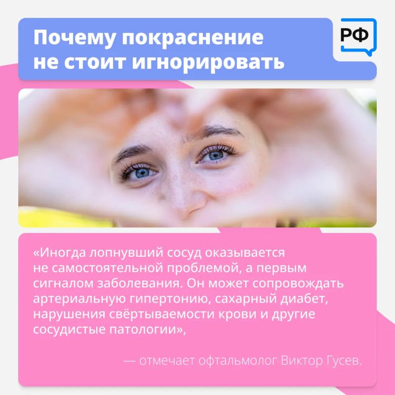 Красные глаза — это красный флаг! Они прямо сигнализируют: пора обратить на них внимание Красные глаза — это красный флаг! Они прямо сигнализируют: пора обратить на них внимание