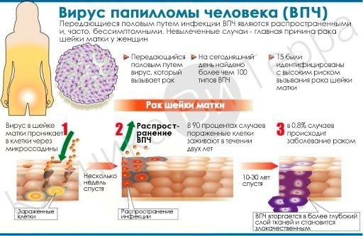 Прививать мальчиков от вируса папилломы человека предложили в Госдуме